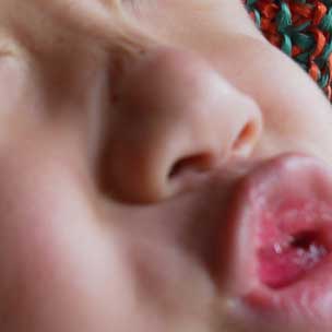 インフルエンザ弱毒性生ワクチン