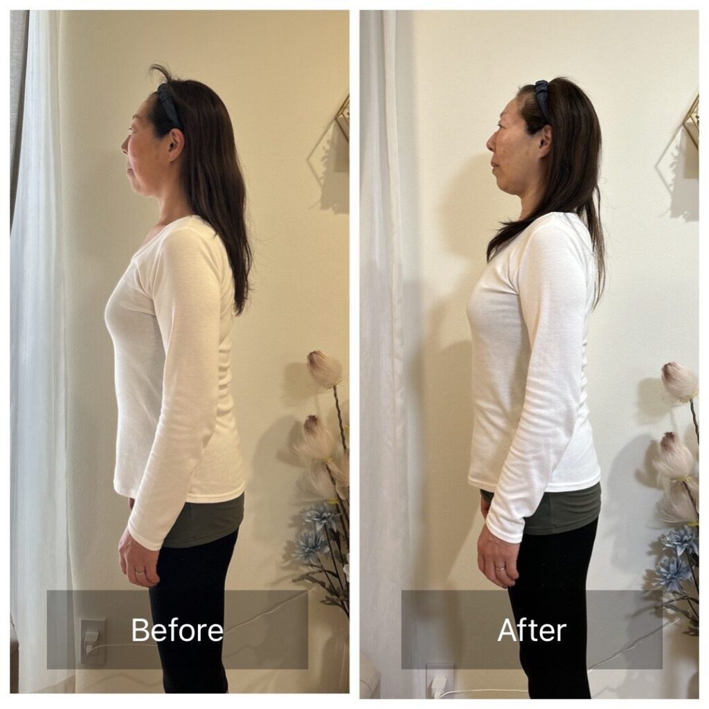 流山おおたかの森リラクゼーションサロン ルアナの施術後ビフォーアフター・レビュー