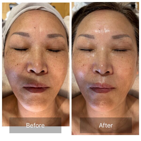 流山おおたかの森リラクゼーションサロン ルアナのフェイシャルエステ・ビフォーアフター