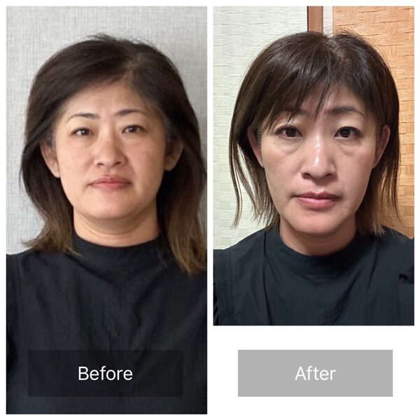 流山おおたかの森リラクゼーションサロン ルアナのプレミアムヘッドマッサージ・ビフォーアフター